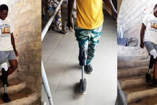 Ugani improves low-cost prosthetics for developing countries via Innovation Boosting project
